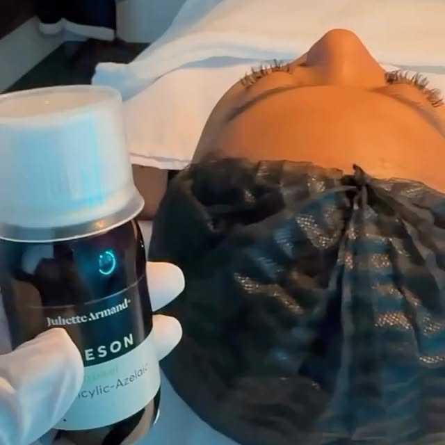 MAesthetics Skin Atelier Calgary Result 6