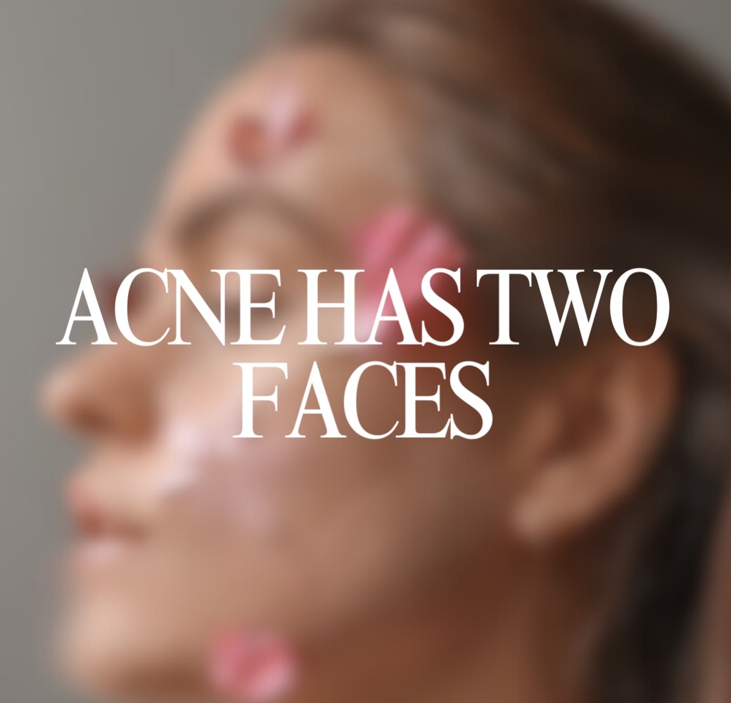 MAesthetics Skin Atelier Calgary Result 11